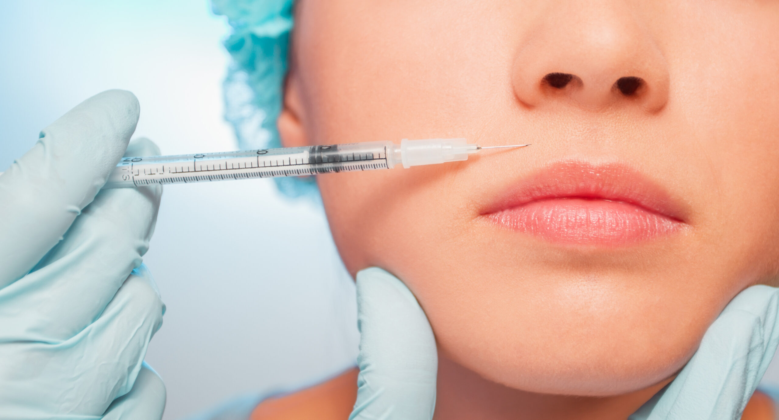 botox injection on nasolabial area