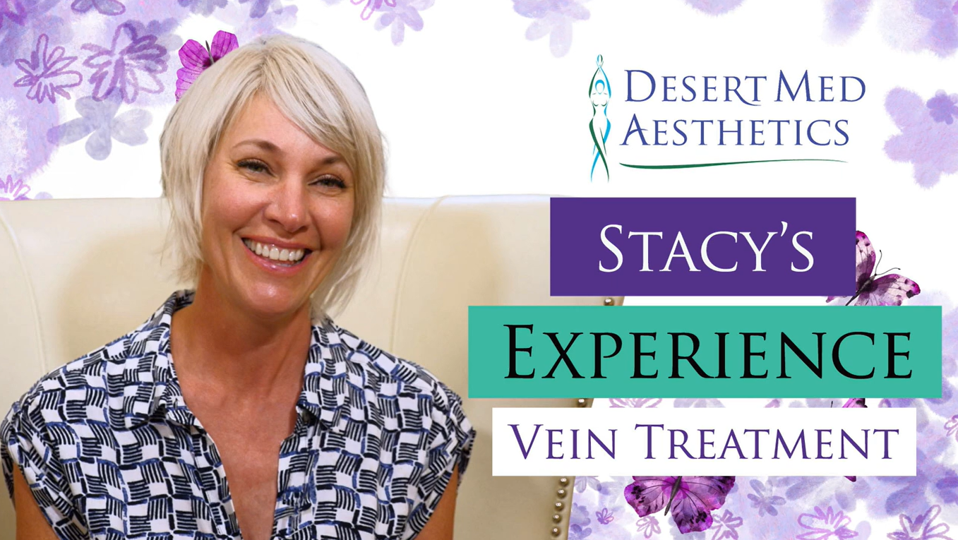 Stacy's Spider Vein Experience | Desert Med Aesthetics